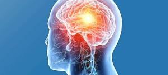 FESS Surgery Image 1